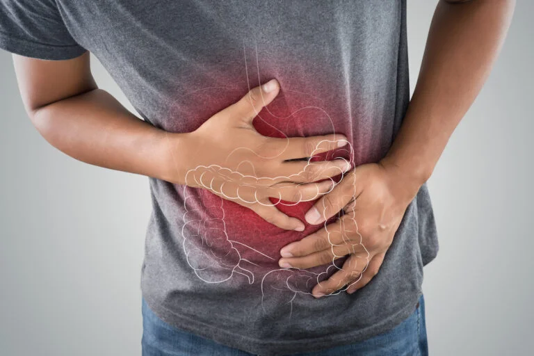 How Can I Prevent Constipation From Opioids For Pain Management? 17 constipation